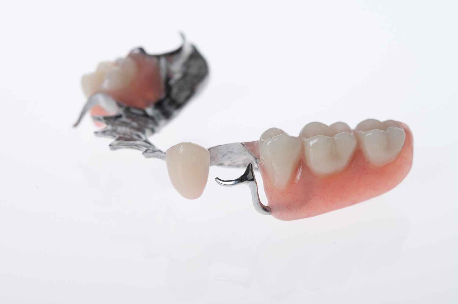 Cobalt Chrome Partial Dentures Gold Coast Costs & Info